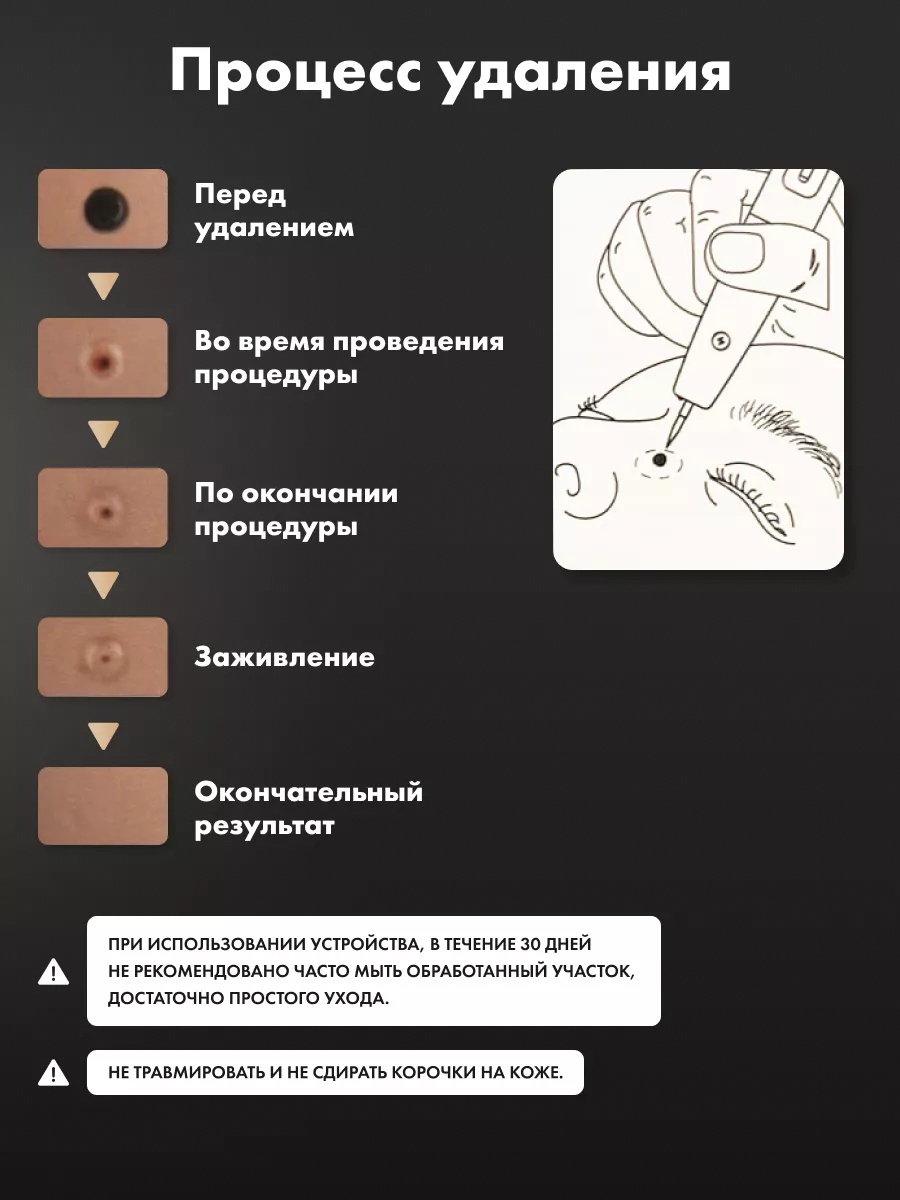 thumb-1
